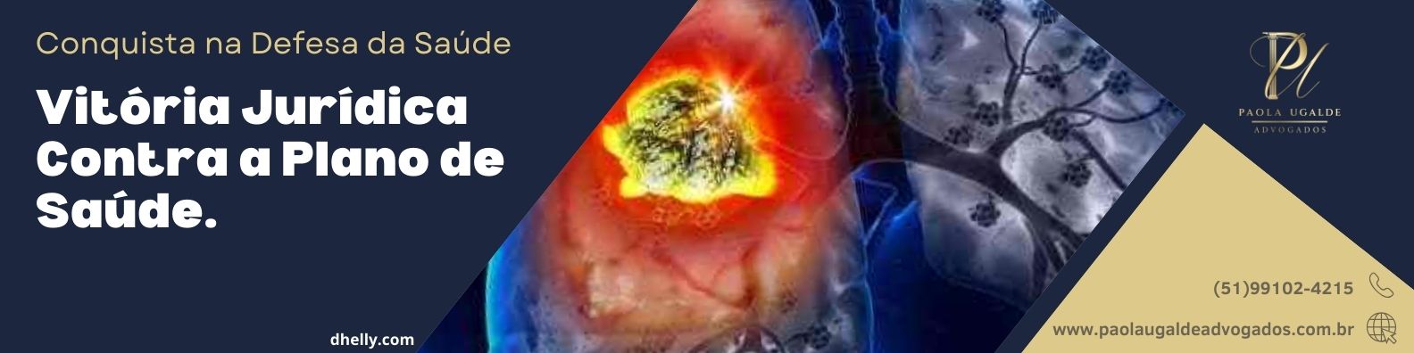 cliente teve a cobertura do tratamento essencial negada, mas através da intervenção judicial, garantimos o acesso ao medicamento Nintedanibe 150mg associado à oxigenoterapia